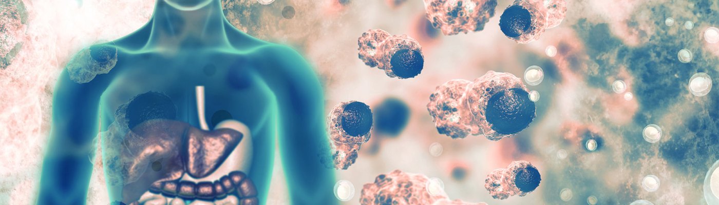 Attacco del virus SARS-CoV-2