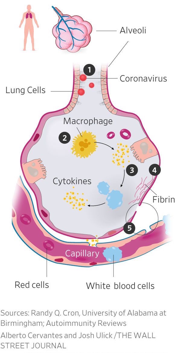 Aumento del valore di D-dimero, un prodotto di degradazione della fibrina generato dai processi infiammatori