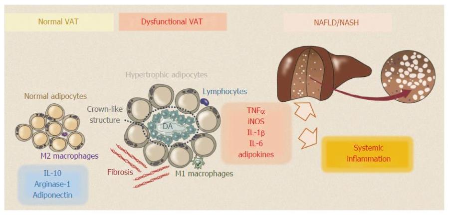 Figura 24 - Associazione dell'ipovitaminosi D all'obesità che alla La malattia del fegato grasso non alcolica (NAFLD). Morini et all. Relationship between adipose tissue dysfunction, vitamin D deficiency and the pathogenesis of non-alcoholic fatty liver disease. World J Gastroenterol 2017; https://pubmed.ncbi.nlm.nih.gov/28596677/